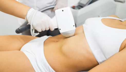 Liposuction in Bangalore: What to Know Before Choosing the Right Clinic